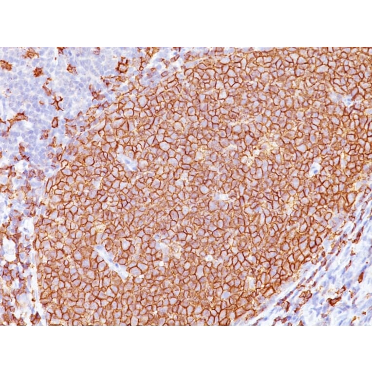 Immunohistochemistry - Anti-CD20 Antibody [L26 + IGEL/773] (A254287) - Antibodies.com