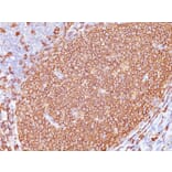 Immunohistochemistry - Anti-CD20 Antibody [L26 + IGEL/773] (A254287) - Antibodies.com