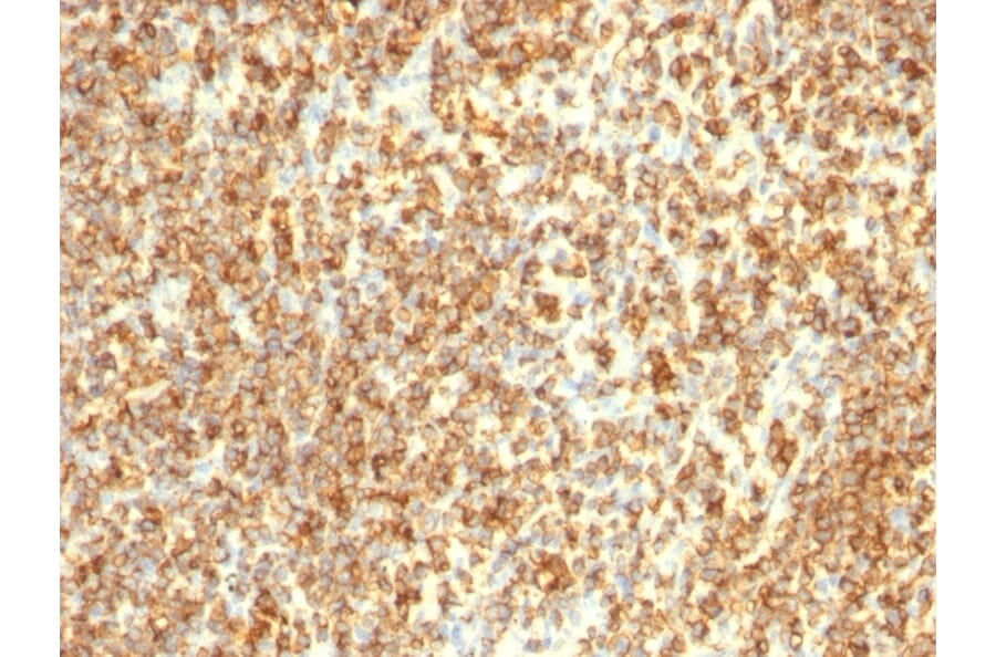 Immunohistochemistry - Anti-CD20 Antibody [L26 + IGEL/773] (A254287) - Antibodies.com