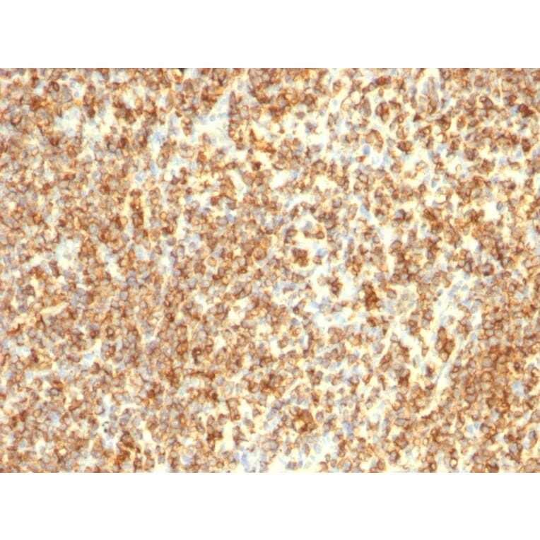 Immunohistochemistry - Anti-CD20 Antibody [L26 + IGEL/773] (A254287) - Antibodies.com