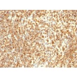 Immunohistochemistry - Anti-CD20 Antibody [L26 + IGEL/773] (A254287) - Antibodies.com
