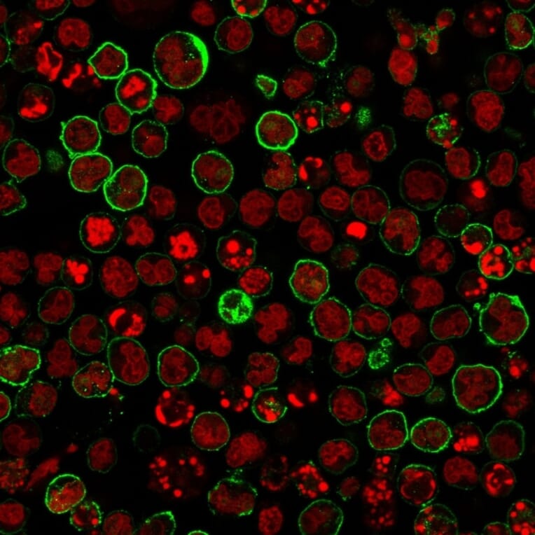 Immunofluorescence - Anti-CD20 Antibody [L26 + IGEL/773] (A254287) - Antibodies.com