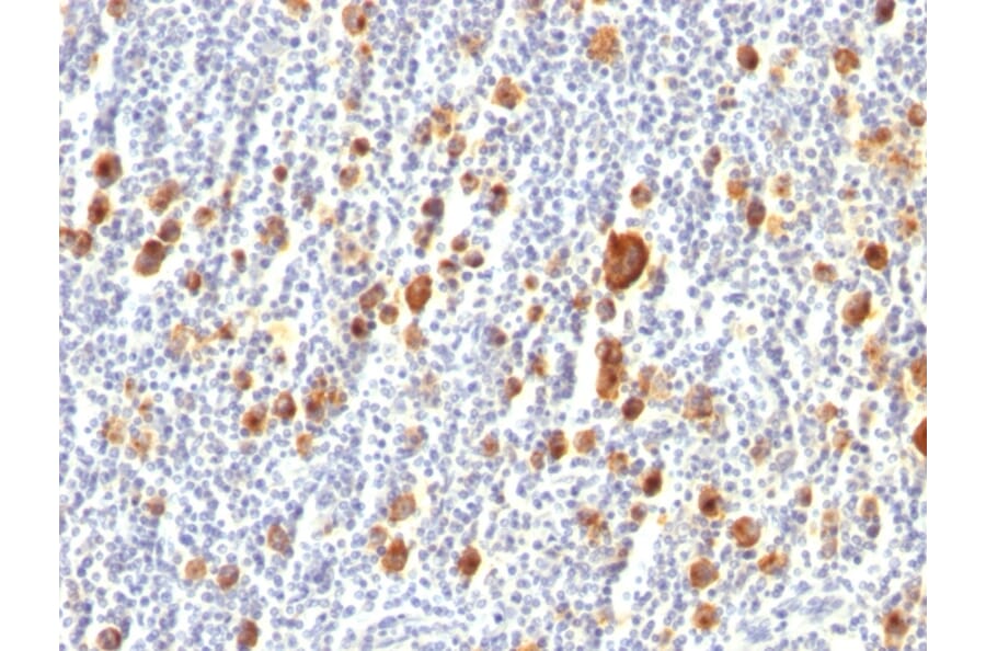 Immunohistochemistry - Anti-CD30 Antibody [Ber-H2] (A254287) - Antibodies.com