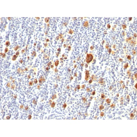 Immunohistochemistry - Anti-CD30 Antibody [Ber-H2] (A254287) - Antibodies.com