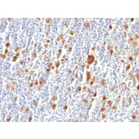 Immunohistochemistry - Anti-CD30 Antibody [Ber-H2] (A254287) - Antibodies.com