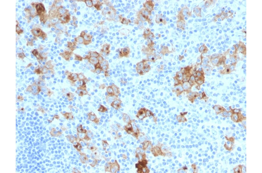 Immunohistochemistry - Anti-CD30 Antibody [SPM121] (A254288) - Antibodies.com
