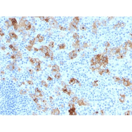 Immunohistochemistry - Anti-CD30 Antibody [SPM121] (A254288) - Antibodies.com