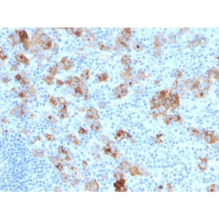 Immunohistochemistry - Anti-CD30 Antibody [SPM121] (A254288) - Antibodies.com
