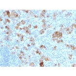 Immunohistochemistry - Anti-CD30 Antibody [SPM121] (A254288) - Antibodies.com