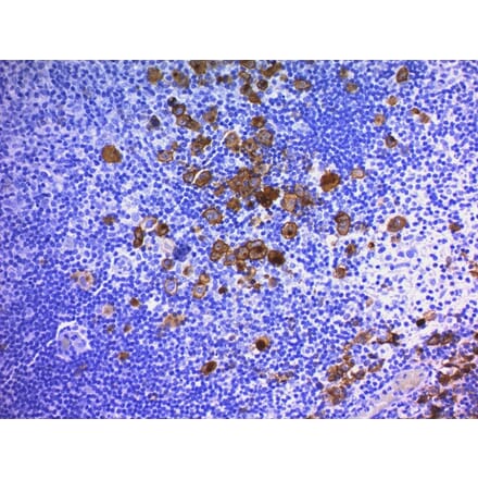 Immunohistochemistry - Anti-CD30 Antibody [Ber-H2 + CD30/412] (A254289) - Antibodies.com