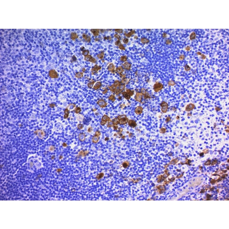 Immunohistochemistry - Anti-CD30 Antibody [Ber-H2 + CD30/412] (A254289) - Antibodies.com