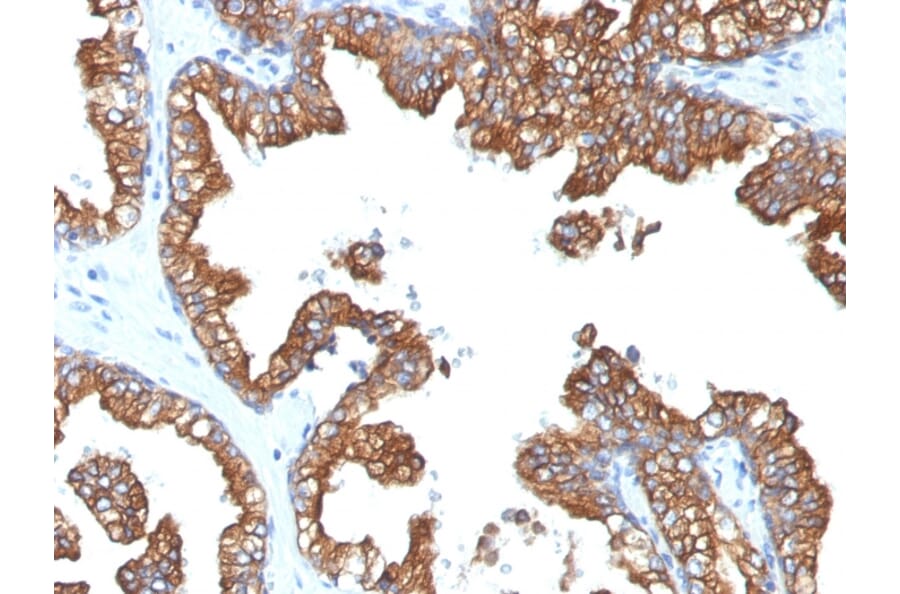 Immunohistochemistry - Anti-Cytokeratin 8 + 18 Antibody [5D3] (A254291) - Antibodies.com