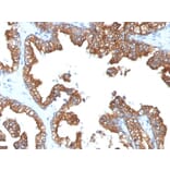 Immunohistochemistry - Anti-Cytokeratin 8 + 18 Antibody [5D3] (A254291) - Antibodies.com
