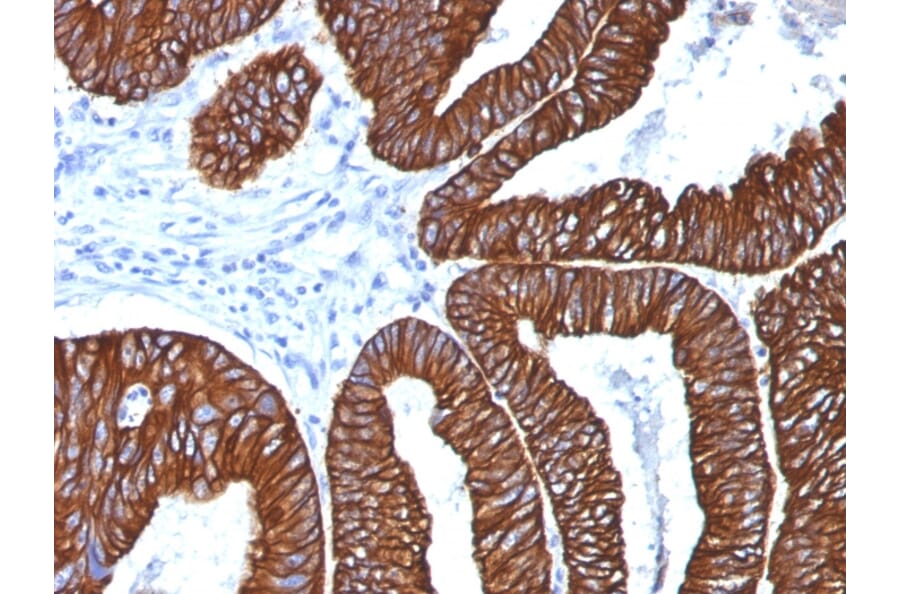 Immunohistochemistry - Anti-Cytokeratin 8 + 18 Antibody [5D3] (A254290) - Antibodies.com