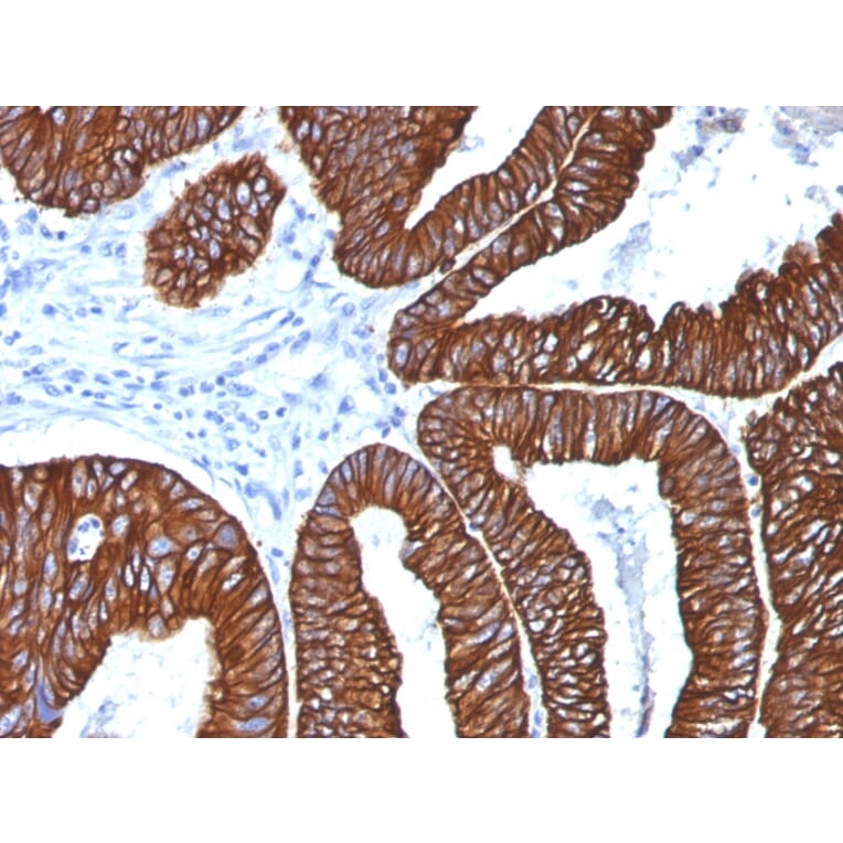 Immunohistochemistry - Anti-Cytokeratin 8 + 18 Antibody [5D3] (A254290) - Antibodies.com