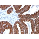 Immunohistochemistry - Anti-Cytokeratin 8 + 18 Antibody [5D3] (A254290) - Antibodies.com