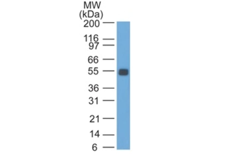 Western Blot - Anti-EpCAM Antibody [GZ-1] (A254291) - Antibodies.com