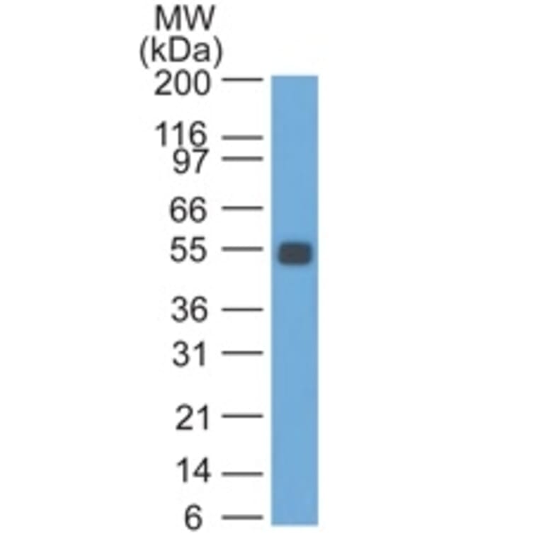 Western Blot - Anti-EpCAM Antibody [GZ-1] (A254291) - Antibodies.com