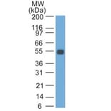 Western Blot - Anti-EpCAM Antibody [GZ-1] (A254291) - Antibodies.com