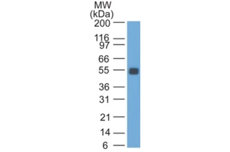 Western Blot - Anti-EpCAM Antibody [SPM534] (A254292) - Antibodies.com