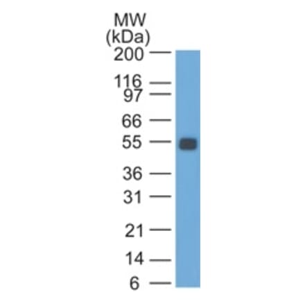 Western Blot - Anti-EpCAM Antibody [SPM534] (A254292) - Antibodies.com