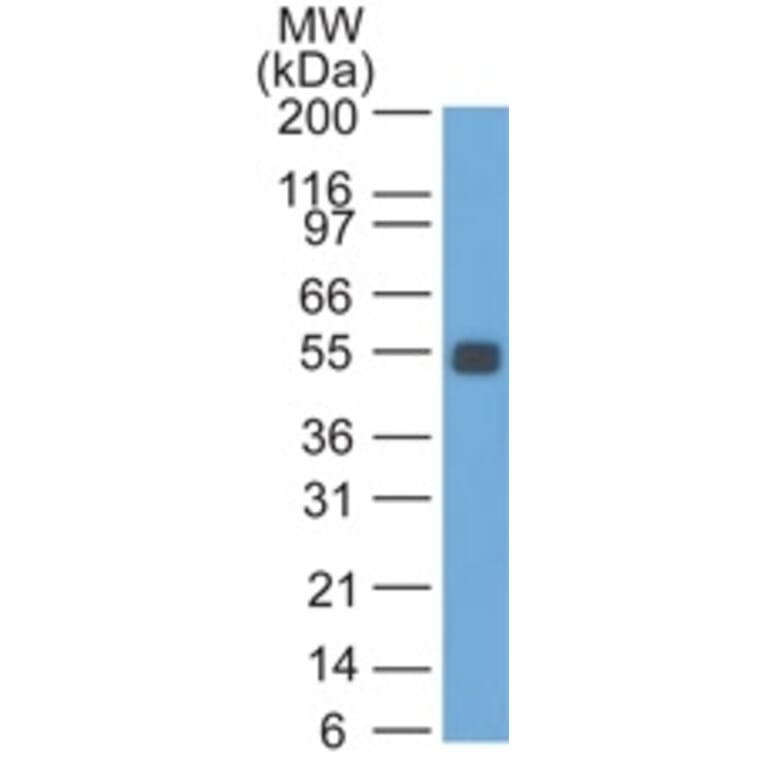 Western Blot - Anti-EpCAM Antibody [SPM534] (A254292) - Antibodies.com