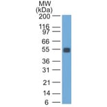 Western Blot - Anti-EpCAM Antibody [SPM534] (A254292) - Antibodies.com