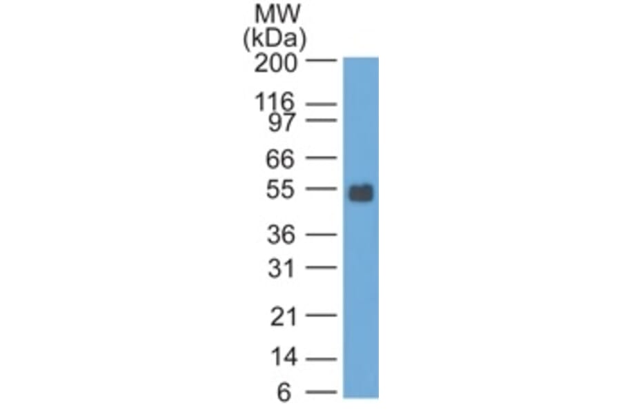 Western Blot - Anti-EpCAM Antibody [SPM535] (A254293) - Antibodies.com