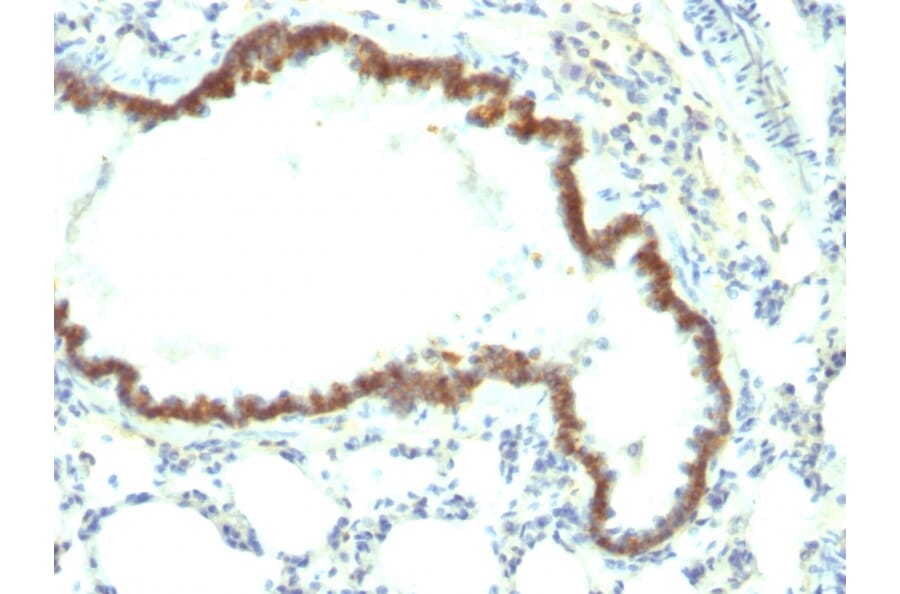 Immunohistochemistry - Anti-EpCAM Antibody [Epcam/1158] (A252423) - Antibodies.com