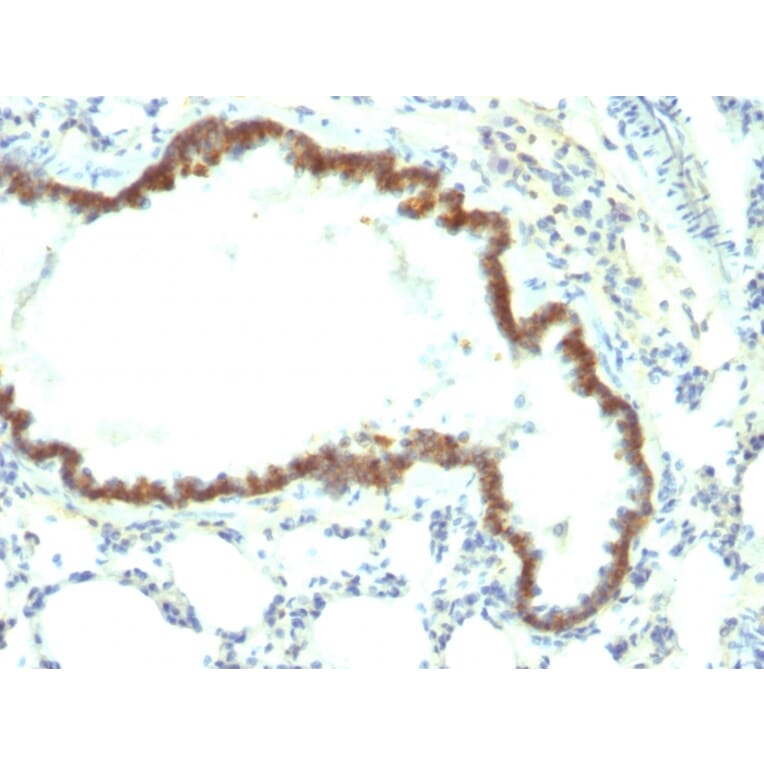 Immunohistochemistry - Anti-EpCAM Antibody [Epcam/1158] (A252423) - Antibodies.com