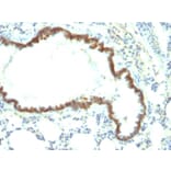 Immunohistochemistry - Anti-EpCAM Antibody [Epcam/1158] (A252423) - Antibodies.com