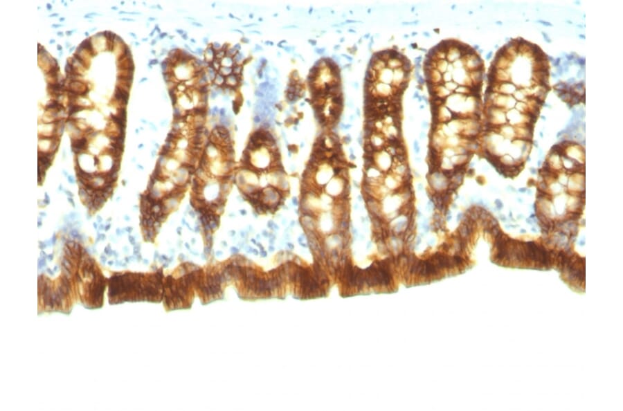 Immunohistochemistry - Anti-EpCAM Antibody [Epcam/1158] (A252423) - Antibodies.com