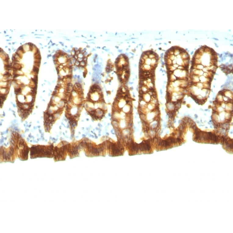 Immunohistochemistry - Anti-EpCAM Antibody [Epcam/1158] (A252423) - Antibodies.com