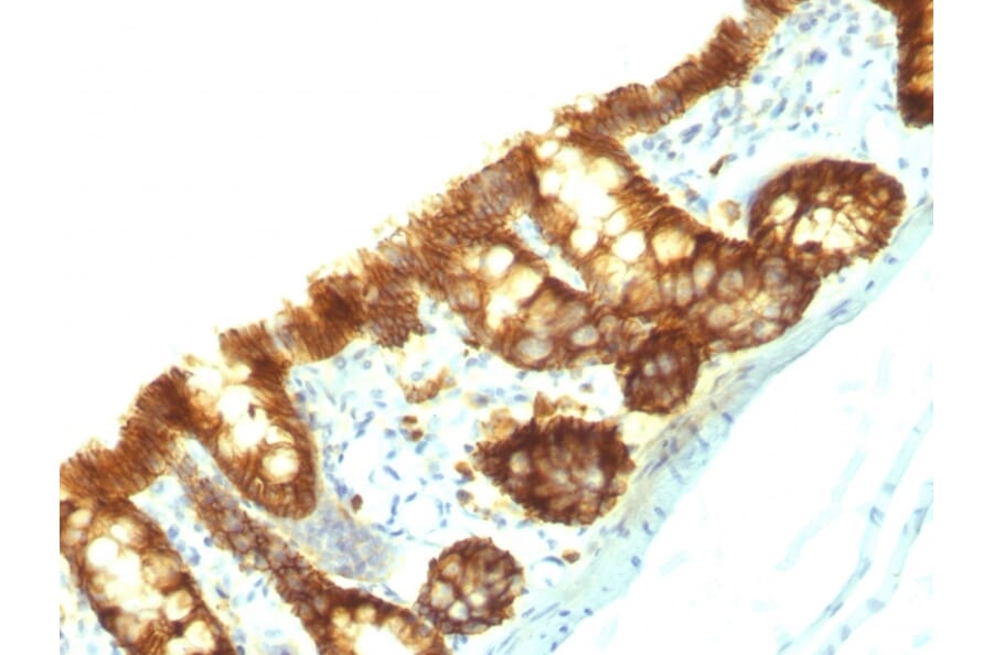 Immunohistochemistry - Anti-EpCAM Antibody [EpCAM/1159] (A254296) - Antibodies.com