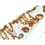 Immunohistochemistry - Anti-EpCAM Antibody [EpCAM/1159] (A254296) - Antibodies.com