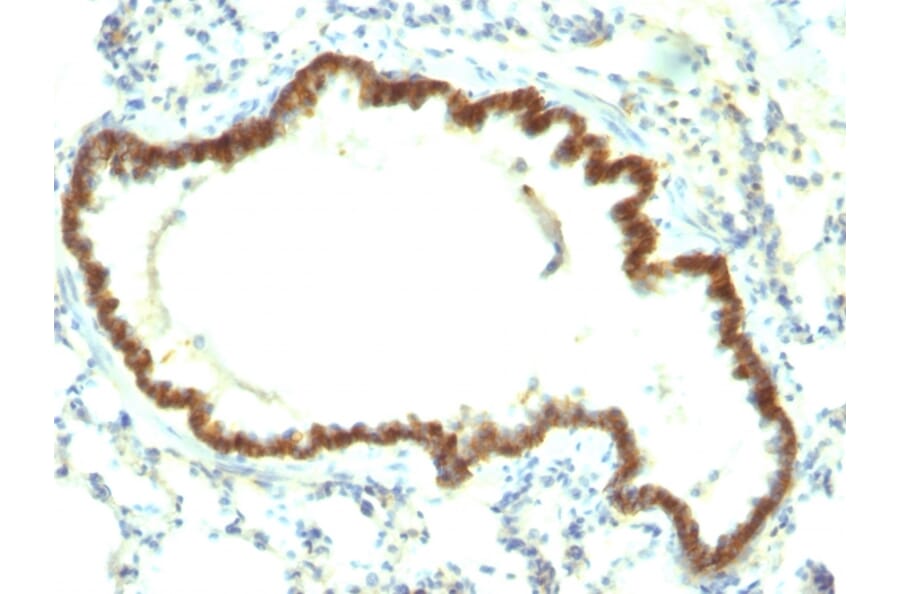 Immunohistochemistry - Anti-EpCAM Antibody [EpCAM/1159] (A254296) - Antibodies.com