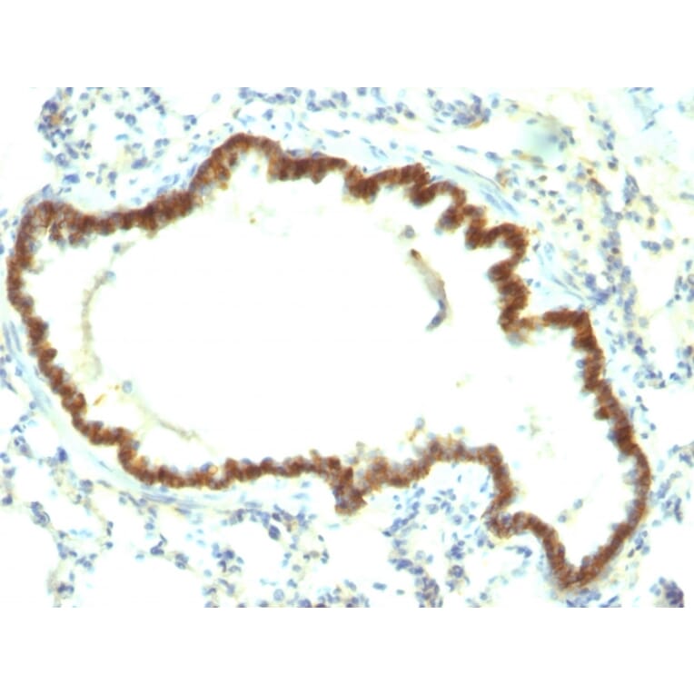 Immunohistochemistry - Anti-EpCAM Antibody [EpCAM/1159] (A254296) - Antibodies.com