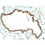 Immunohistochemistry - Anti-EpCAM Antibody [EpCAM/1159] (A254296) - Antibodies.com