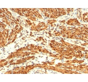 Immunohistochemistry - Anti-Calponin 1 Antibody [CNN1/832 + CALP] - BSA and Azide free (A254299) - Antibodies.com