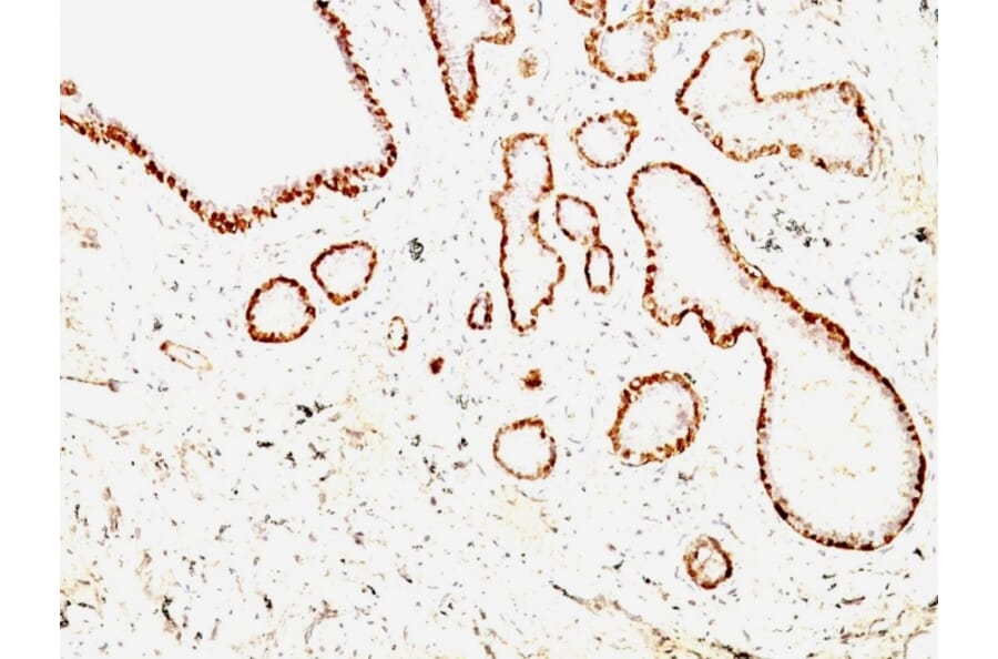 Immunohistochemistry - Anti-Calponin 1 Antibody [CNN1/832 + CALP] - BSA and Azide free (A254299) - Antibodies.com