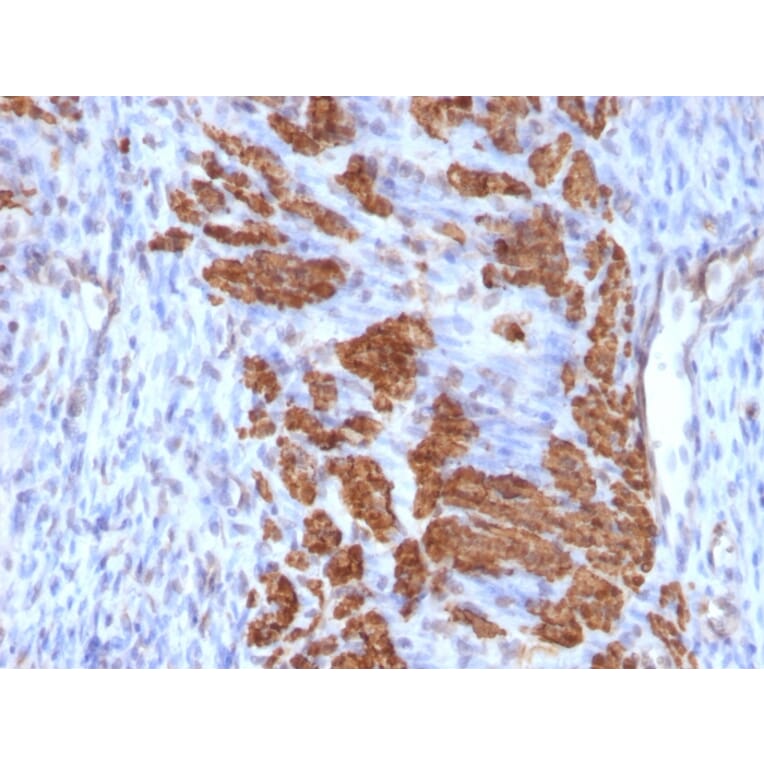 Immunohistochemistry - Anti-Calponin 1 Antibody [CNN1/832 + CALP] - BSA and Azide free (A254299) - Antibodies.com
