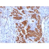 Immunohistochemistry - Anti-Calponin 1 Antibody [CNN1/832 + CALP] - BSA and Azide free (A254299) - Antibodies.com