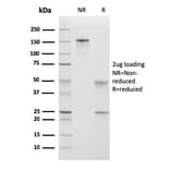 SDS-PAGE - Anti-Calponin 1 Antibody [CNN1/832 + CALP] - BSA and Azide free (A254299) - Antibodies.com
