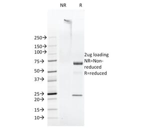 SDS-PAGE - Anti-FAT1 Antibody [FAT1-3D7/1] - BSA and Azide free (A254299) - Antibodies.com