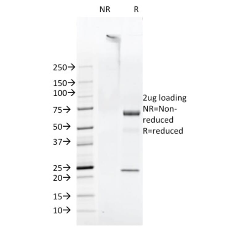 SDS-PAGE - Anti-FAT1 Antibody [FAT1-3D7/1] - BSA and Azide free (A254299) - Antibodies.com