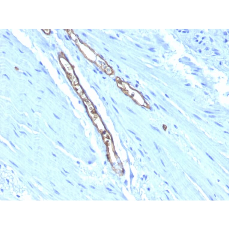 Immunohistochemistry - Anti-Blood Group Antigen A Antibody [HE-193] - BSA and Azide free (A254319) - Antibodies.com