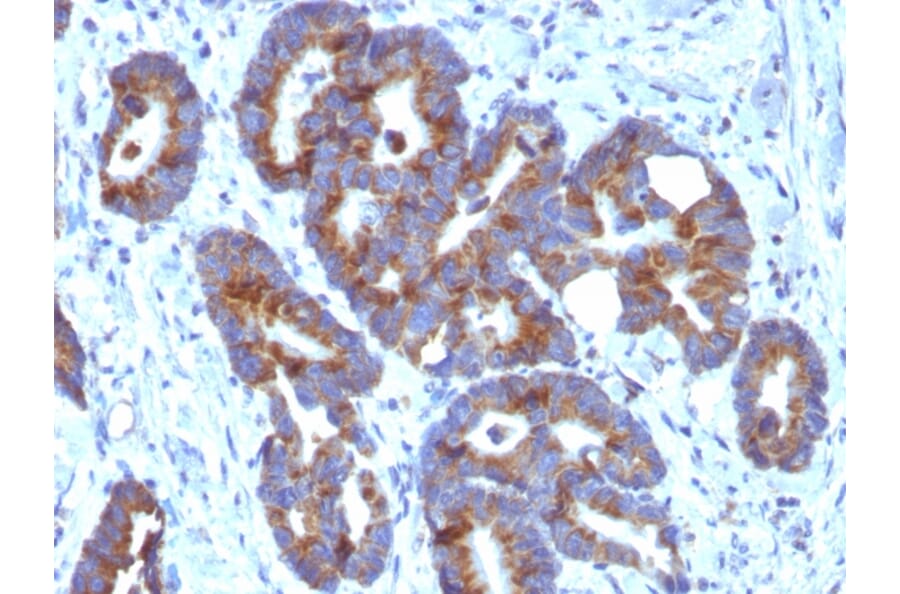 Immunohistochemistry - Anti-Blood Group Antigen A Antibody [HE-10] - BSA and Azide free (A254321) - Antibodies.com