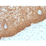 Immunohistochemistry - Anti-Cytokeratin 14 Antibody [KRT14/532] - BSA and Azide free (A254323) - Antibodies.com