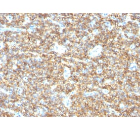 Immunohistochemistry - Anti-CD99 Antibody [HO36-1.1] - BSA and Azide free (A254326) - Antibodies.com
