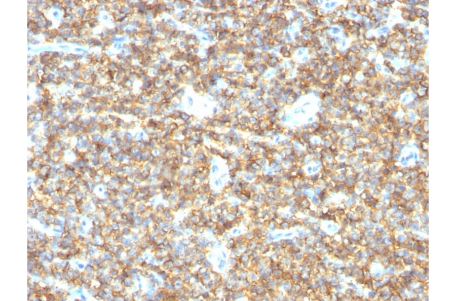 Immunohistochemistry - Anti-CD99 Antibody [HO36-1.1] - BSA and Azide free (A254326) - Antibodies.com